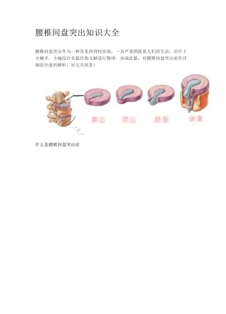 腰椎间盘突出知识大全