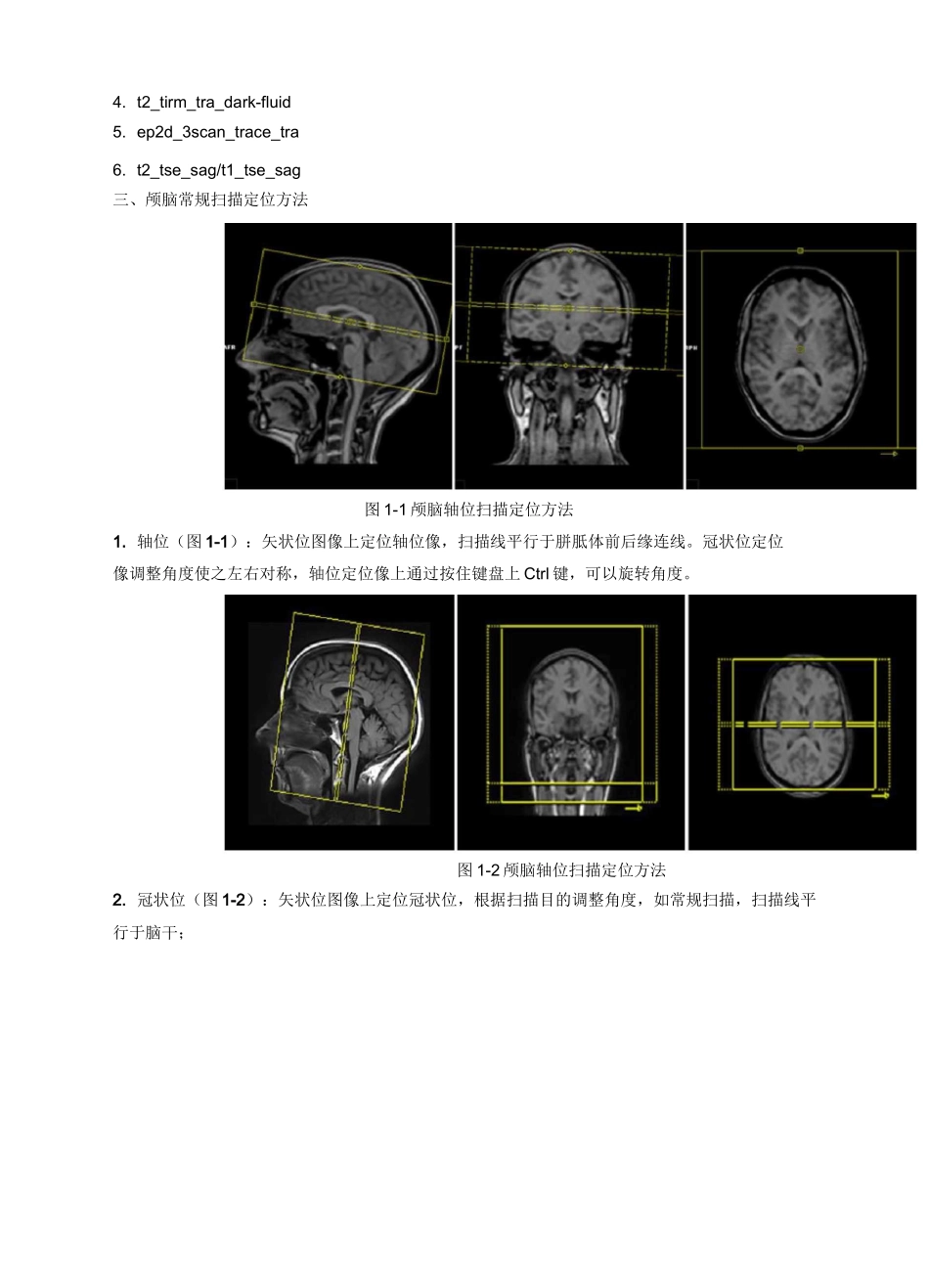 西门子磁共振常规扫描流程介绍_第2页
