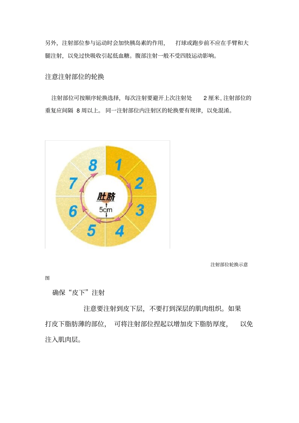 胰岛素的注射部位_第2页