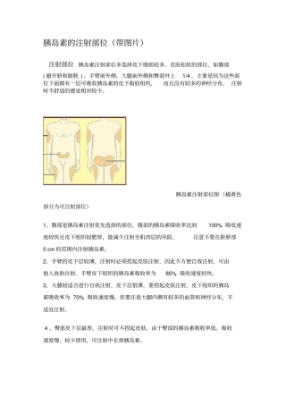 胰岛素的注射部位