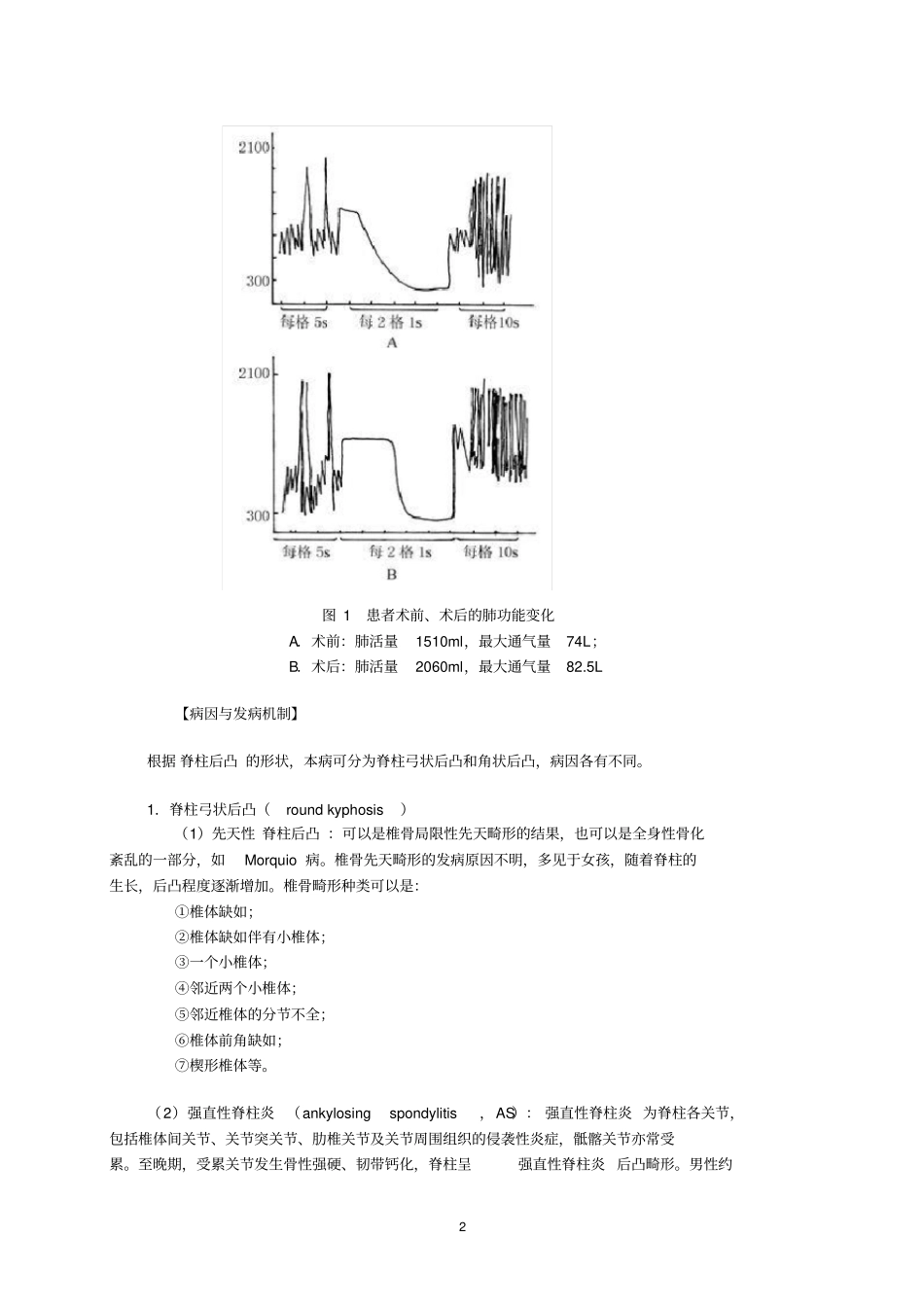 脊柱后凸讲义_第2页