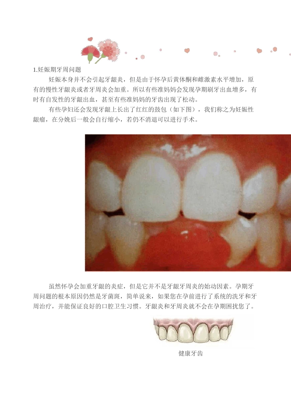 健康说： 孕妈妈的口腔保健知识_第2页