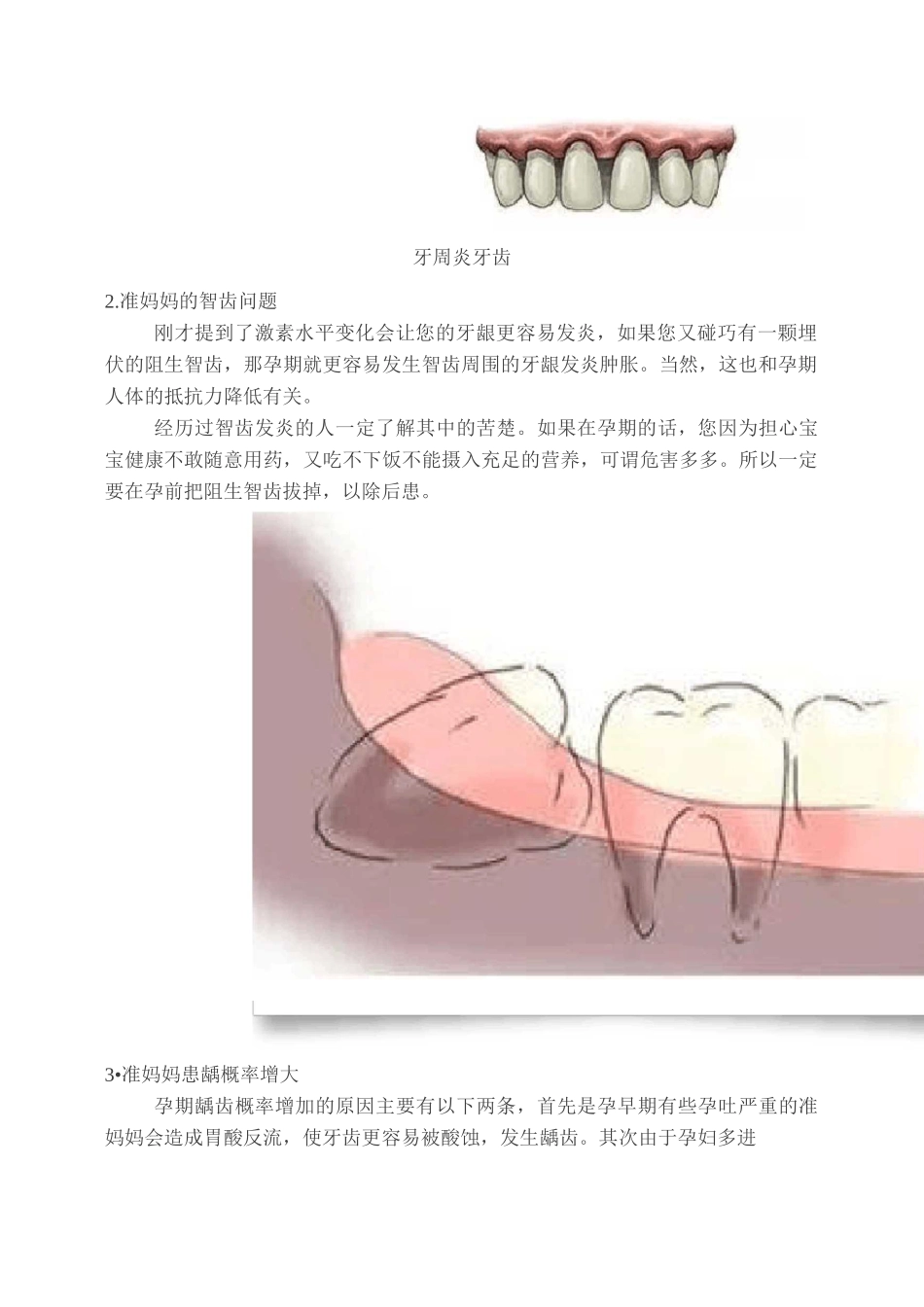 健康说： 孕妈妈的口腔保健知识_第3页