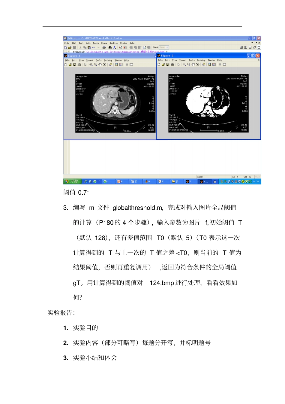 试验9边缘检测和阈值处理_第3页