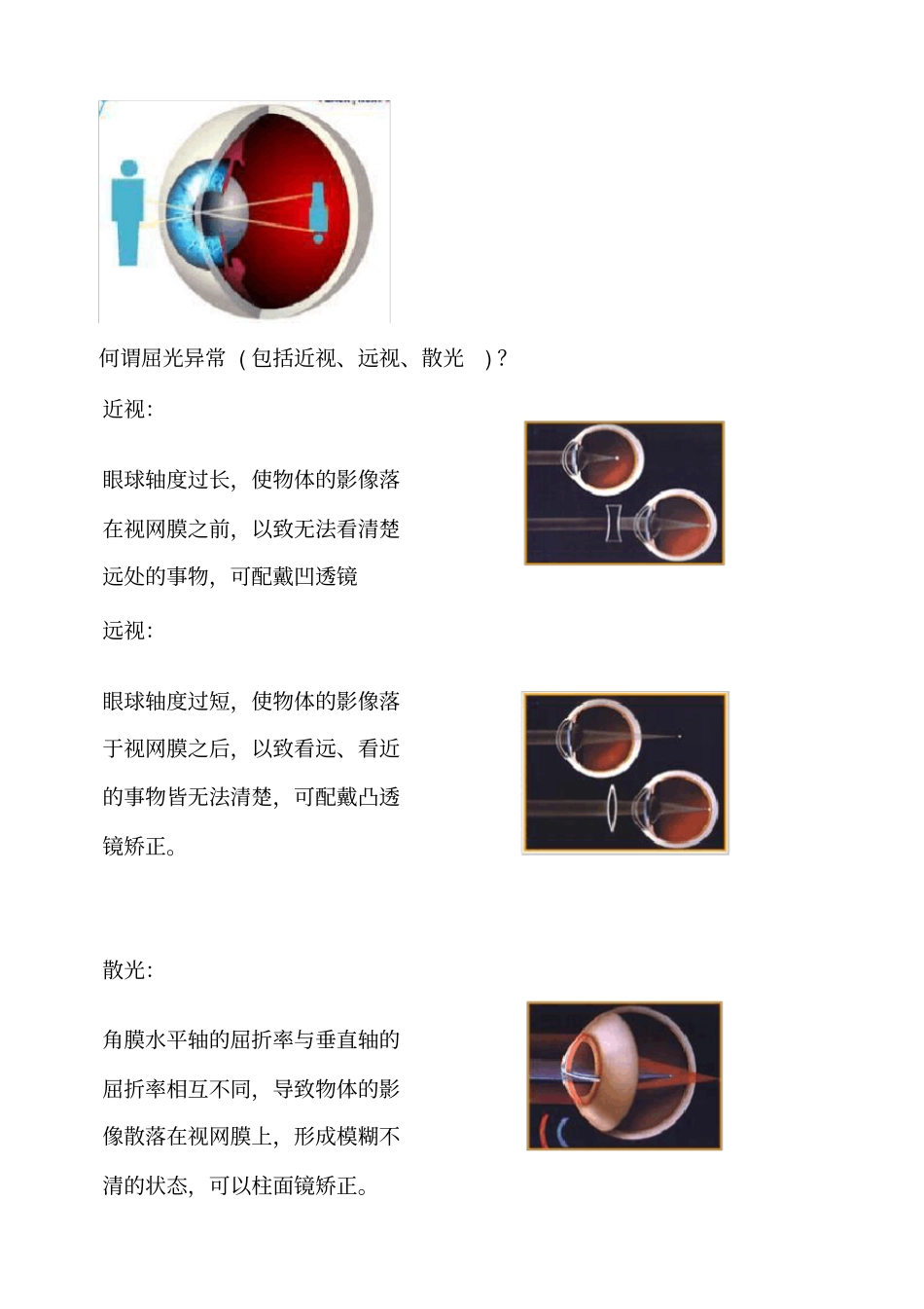 近视眼的自我防治和雾视疗法_第3页