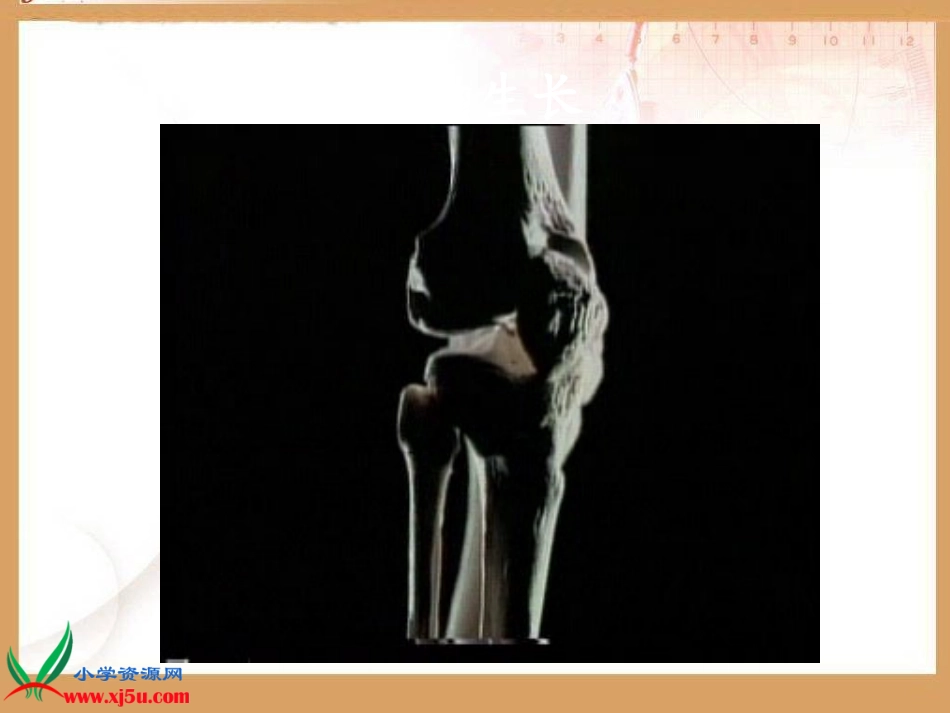（苏教版）四年级科学下册课件11骨骼(2)_第2页
