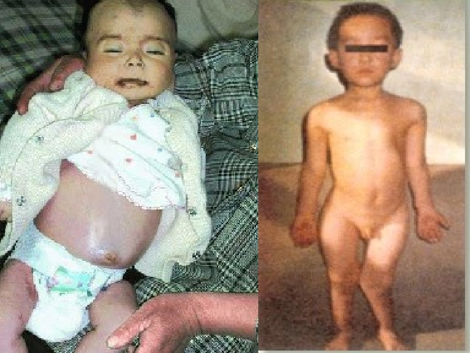 蛋白质和维生素_第2页