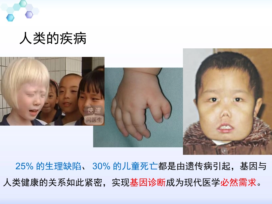 科学·技术·社会-基因治疗-(2)_第2页