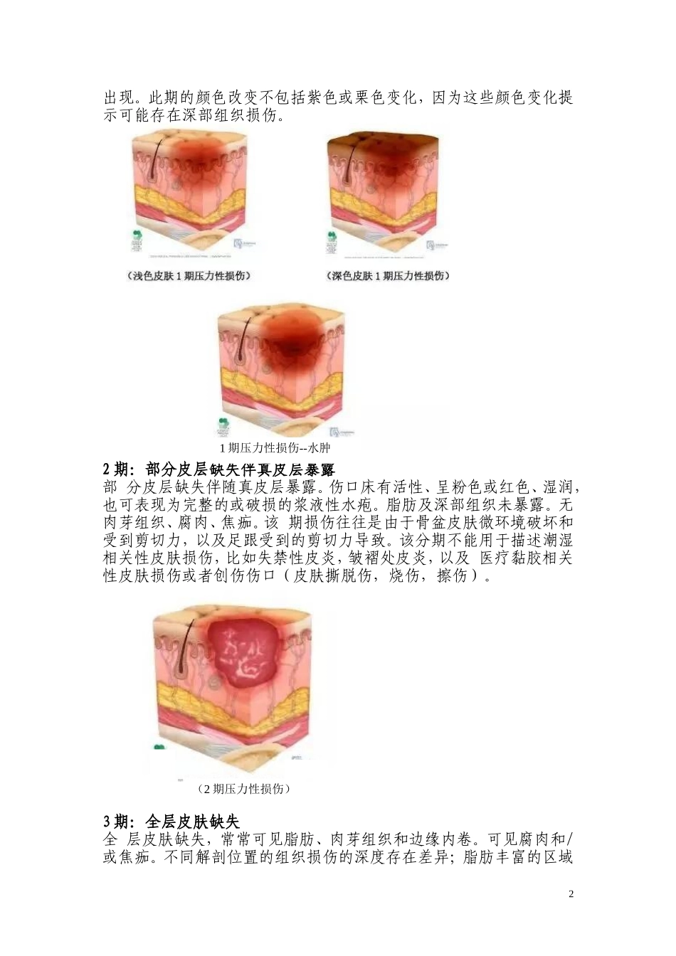2018年压疮诊疗及护理规范_第3页