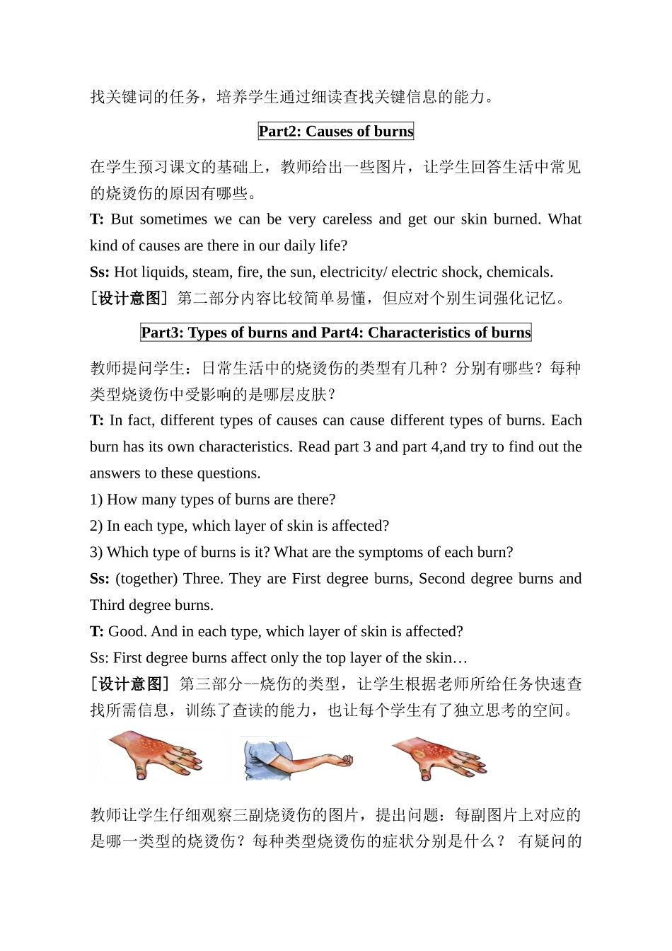 新人教版高中英语必修五《Unit5-First-Aid-First-Aid-for-Burns-Reading》教学设计_第3页