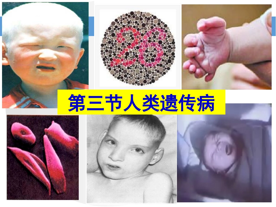 人类遗传病2015_第1页