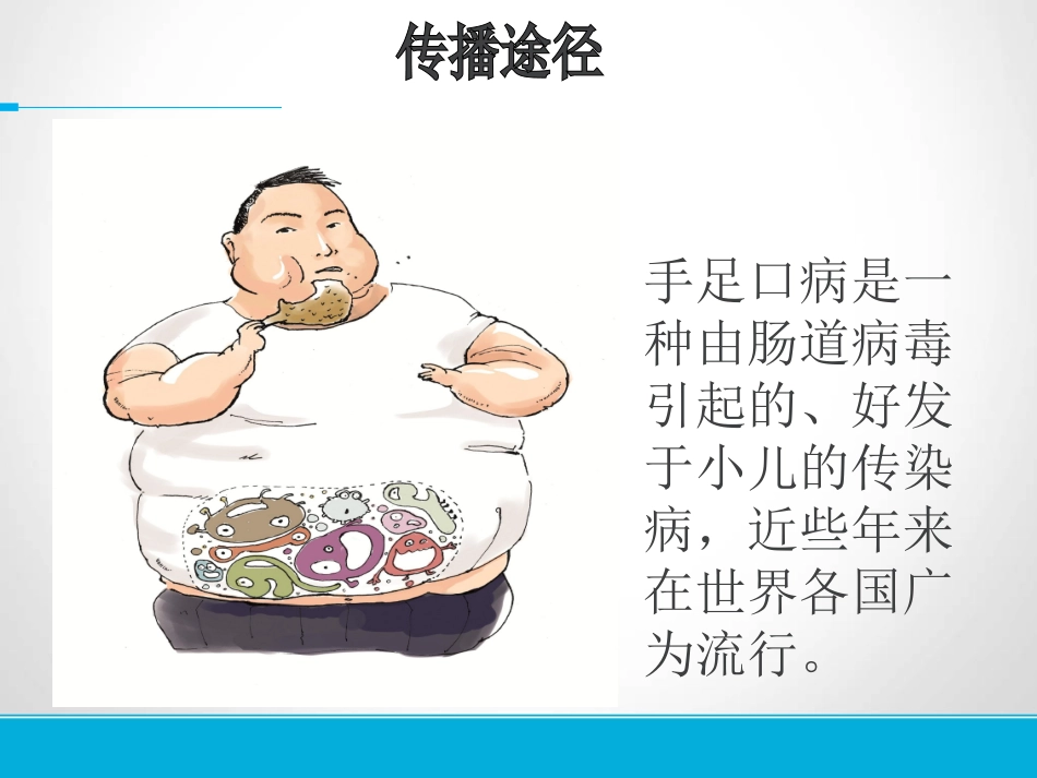 《手足口病的预防》胡晓敏龙岗智鑫幼儿园_第3页
