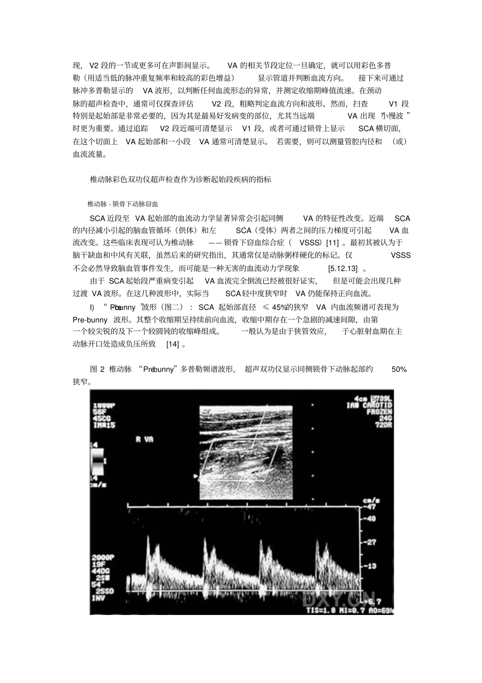 颅外椎动脉超声检查全解_第3页