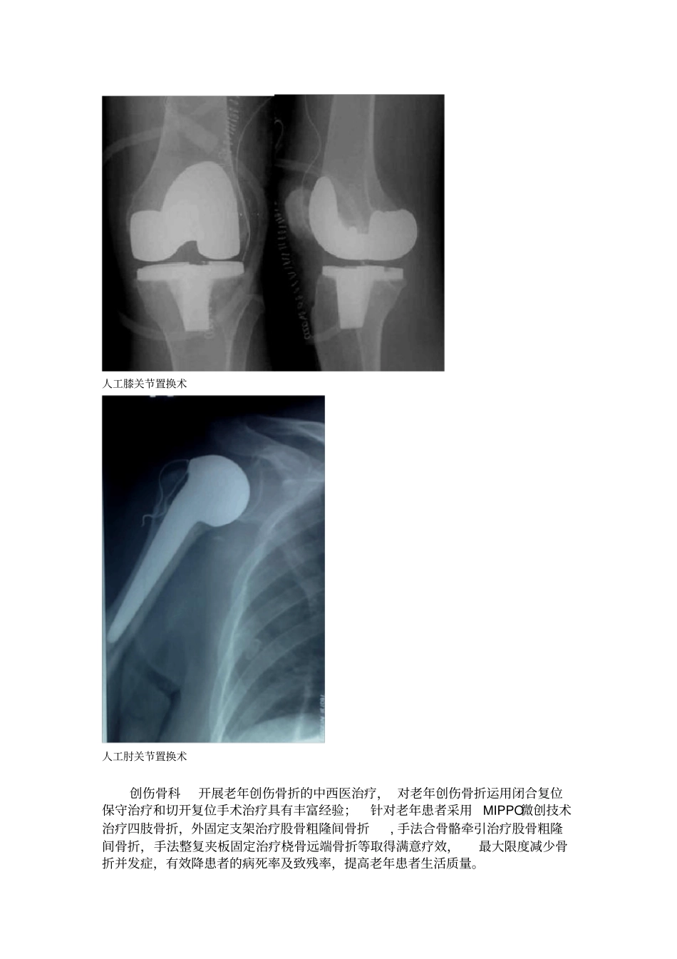 骨伤科科室简介_第2页