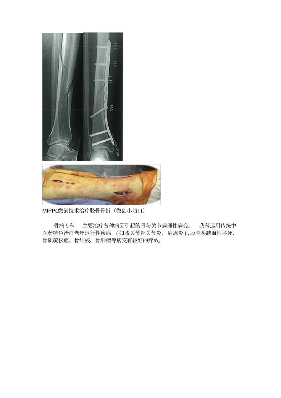 骨伤科科室简介_第3页