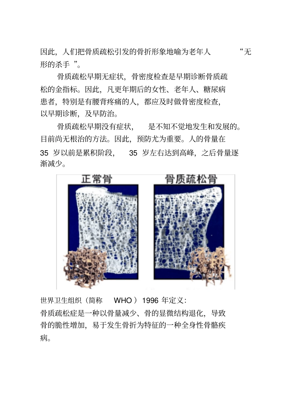 骨质疏松宣传册子_第3页