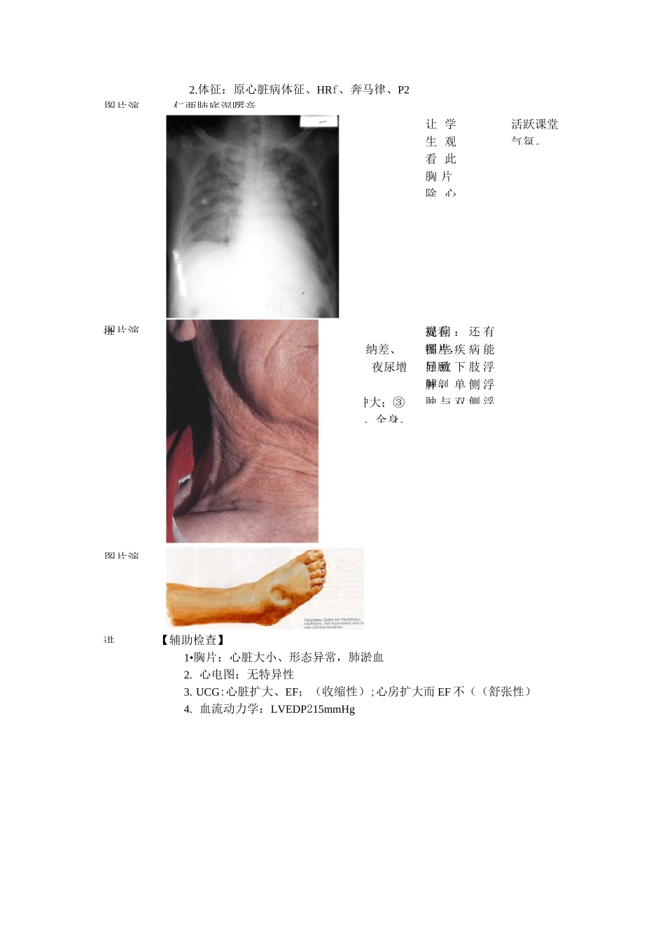 心血管内科(心内科)_见习教案_心力衰竭_第3页