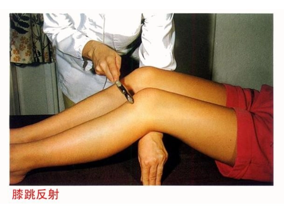 神经调节的基本方式_第2页