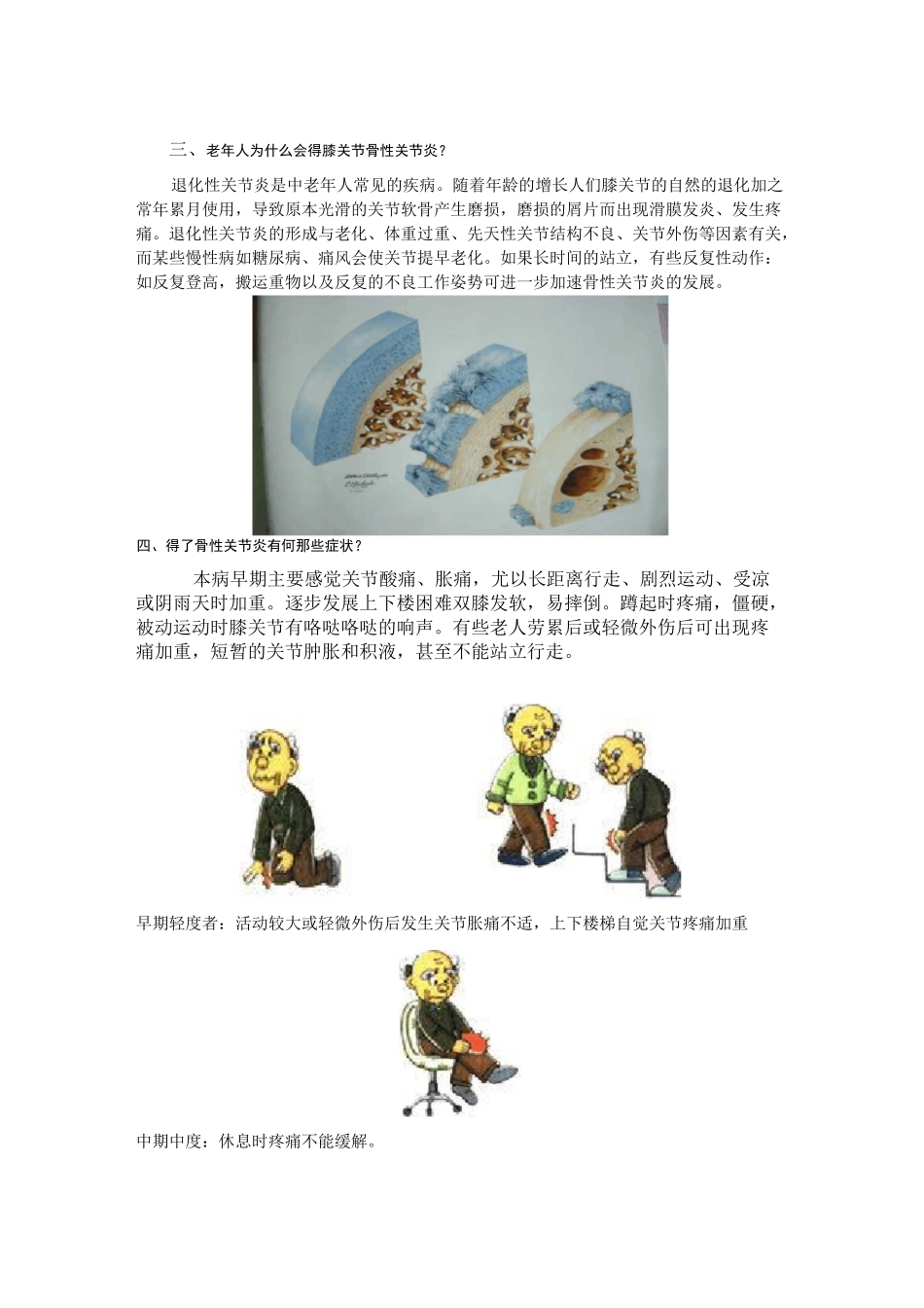 膝关节骨性关节炎的健康知识问答讲解_第2页