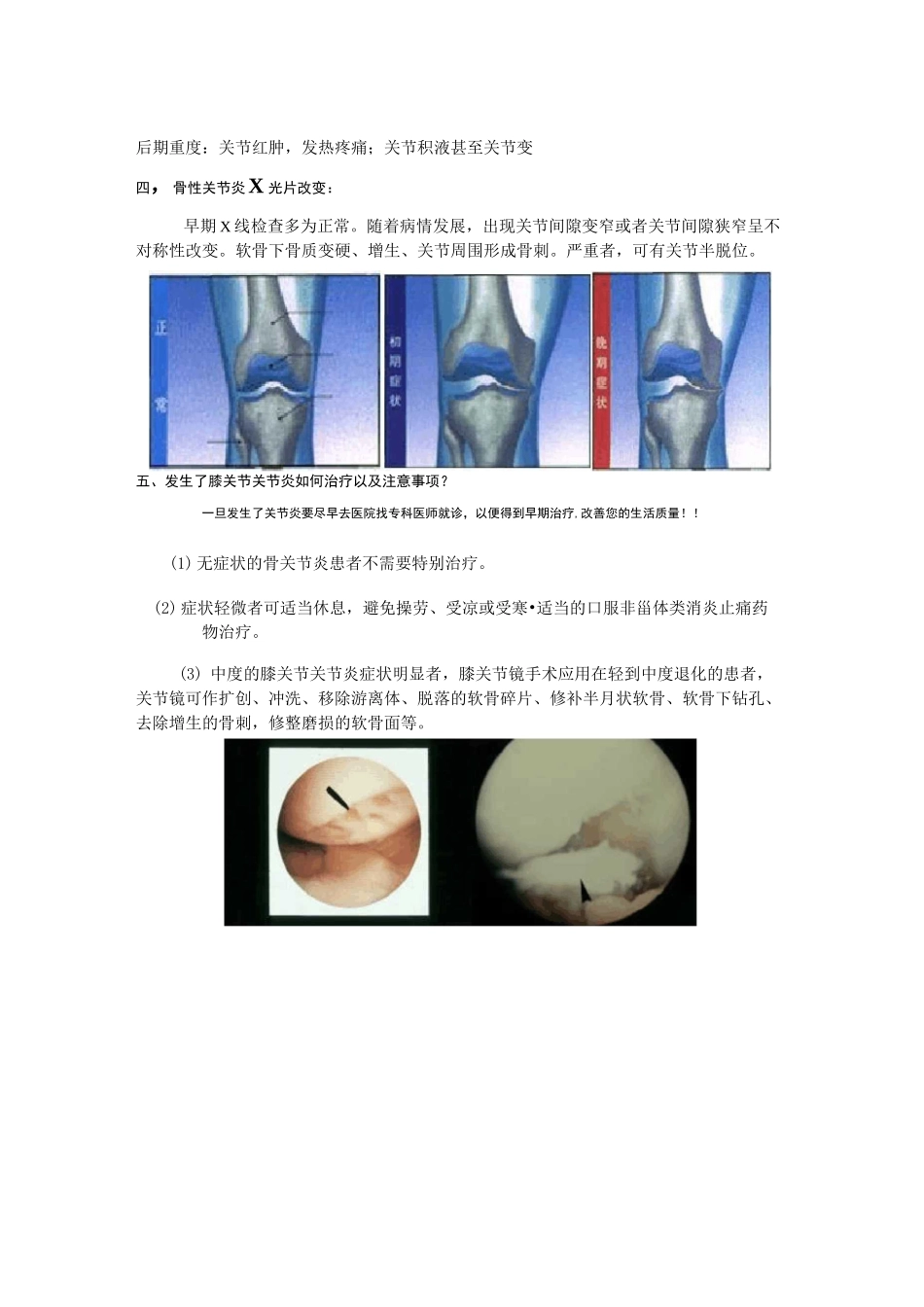 膝关节骨性关节炎的健康知识问答讲解_第3页