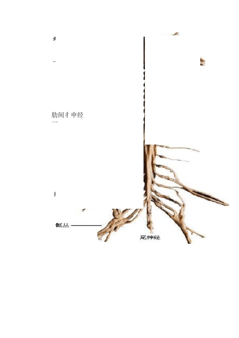脊神经解剖--陈军民_第2页