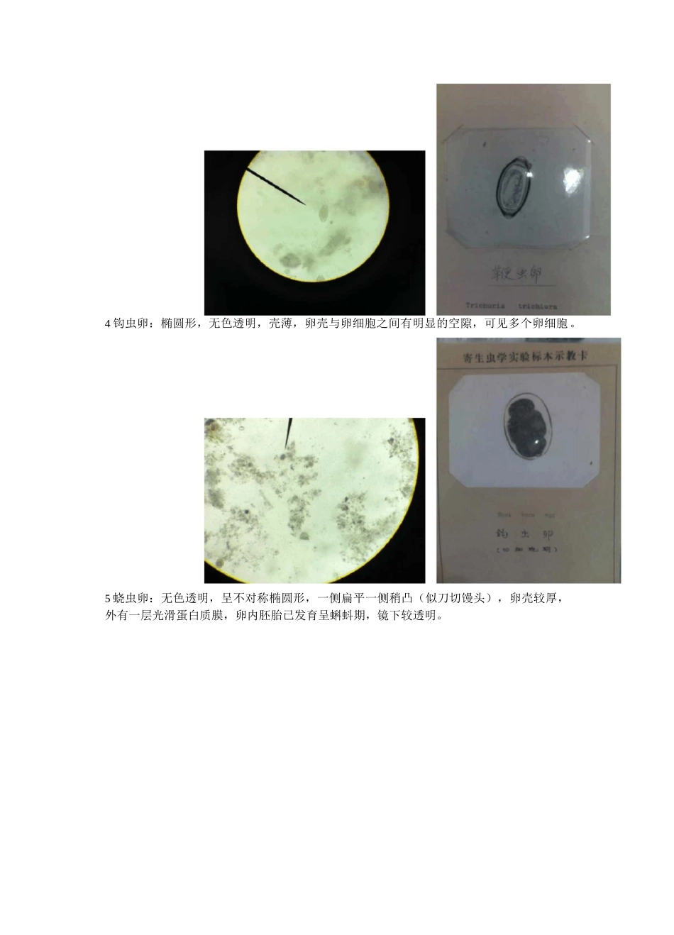 寄生虫实验鉴别要点_第2页