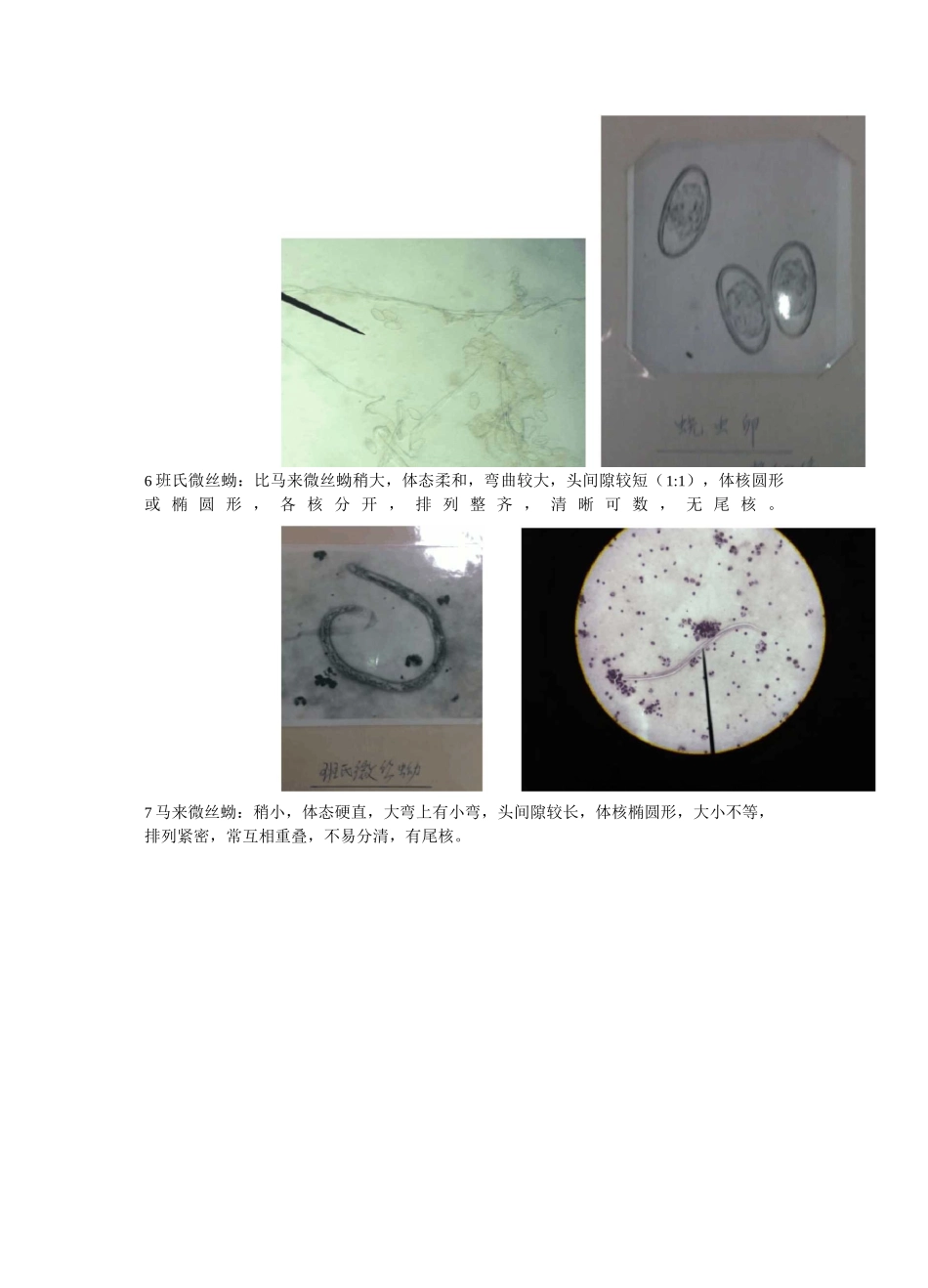 寄生虫实验鉴别要点_第3页