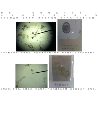 寄生虫实验鉴别要点