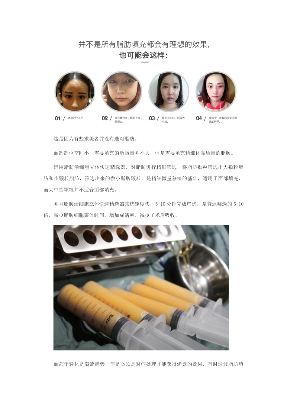 “面部年轻化易容术“是什么_第3页