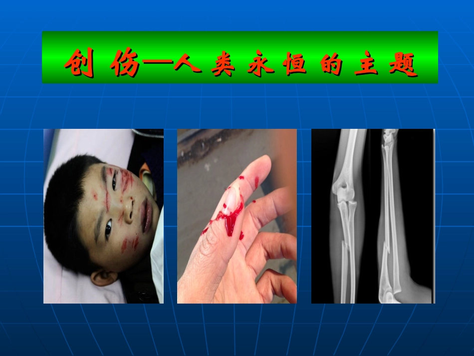 逃生与救护知识-(6)_第3页