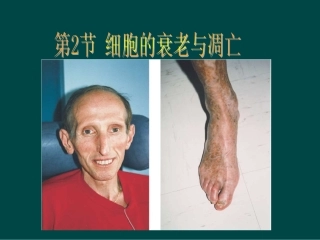 高中生物：-42-细胞的衰老与凋亡(课件)中图版必修1