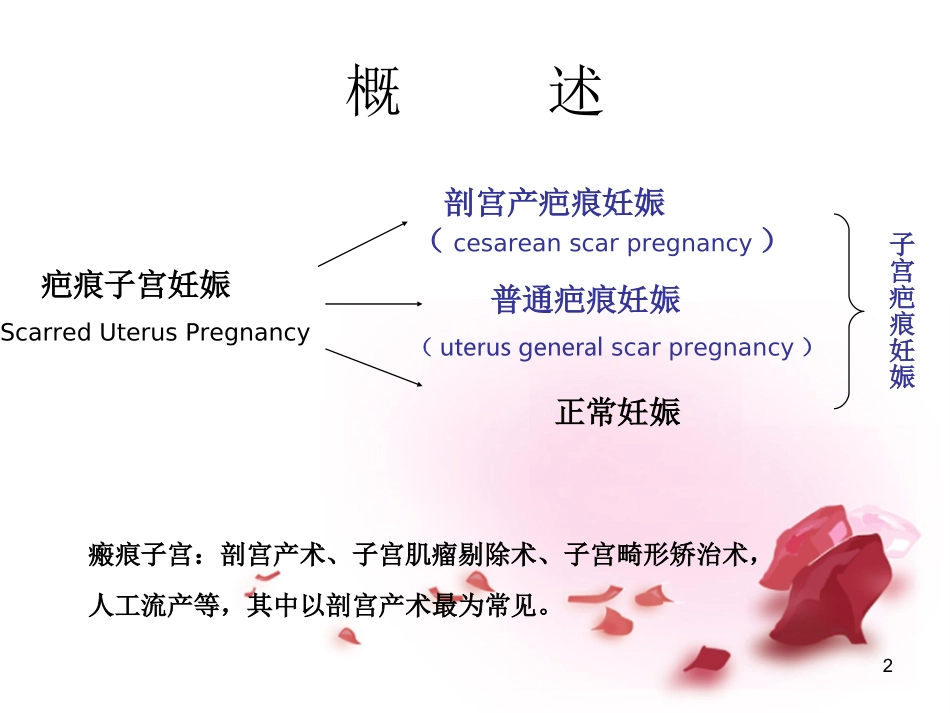 疤痕妊娠的影像学诊断课件_第2页