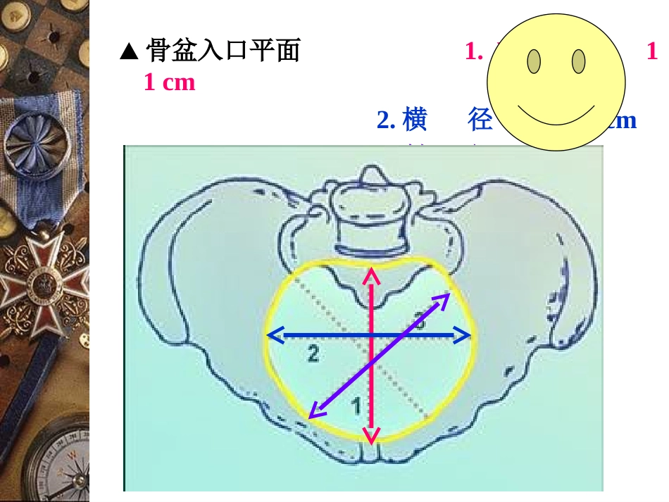 妇产科课件--骨盆内、外测量_第3页