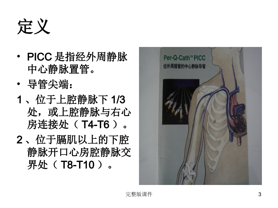 新生儿PICC置管及护理课件_第3页