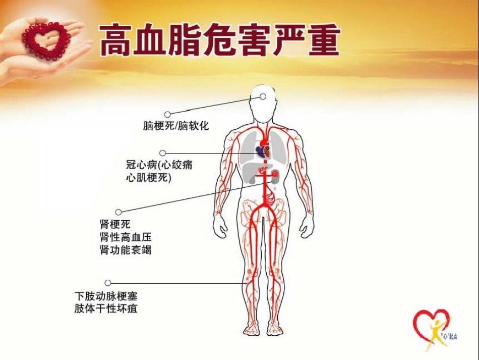 最精彩的高血脂患者健康宣教课件_第3页
