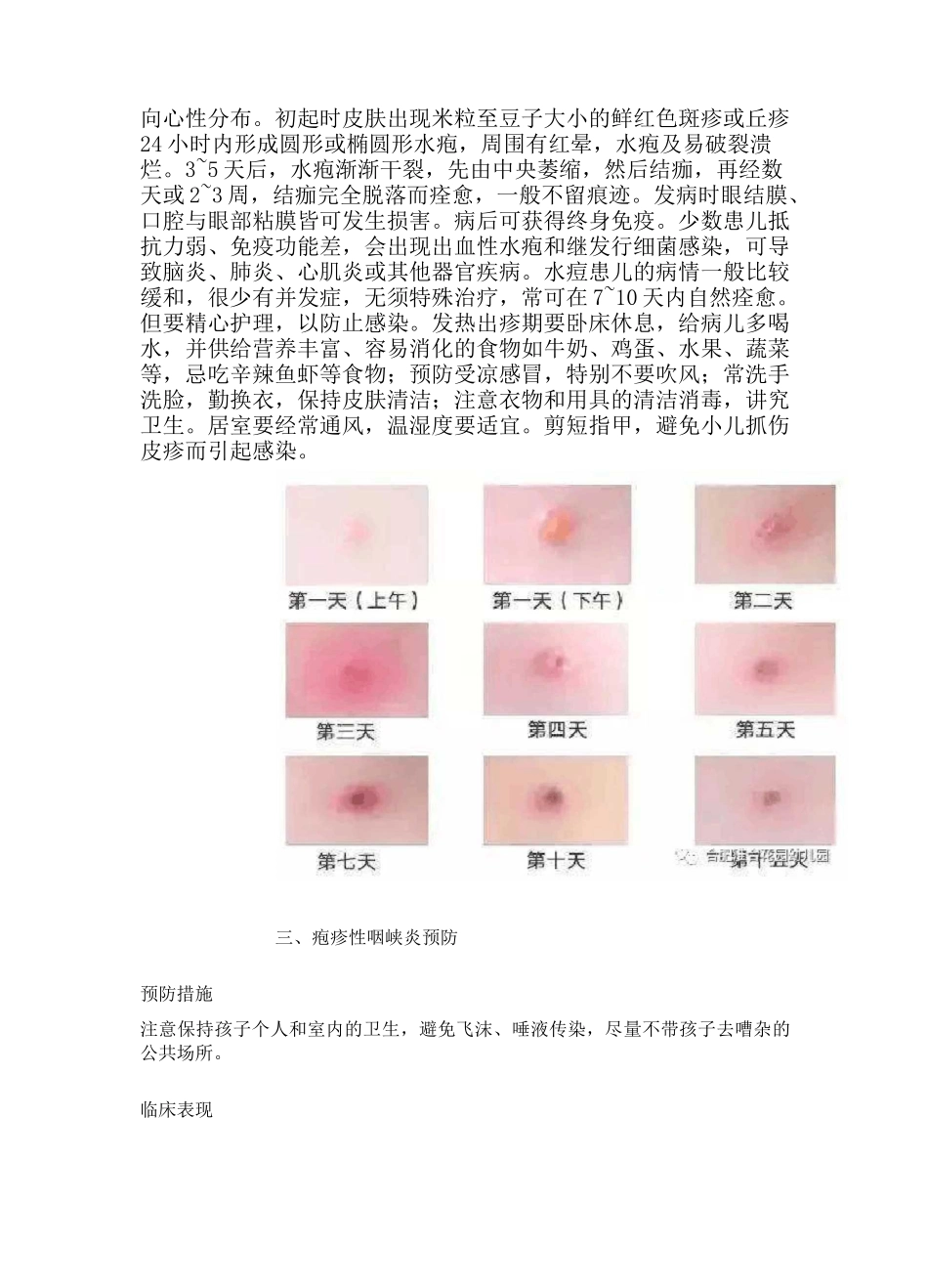 秋冬季常见传染病预防知识宣传_第3页