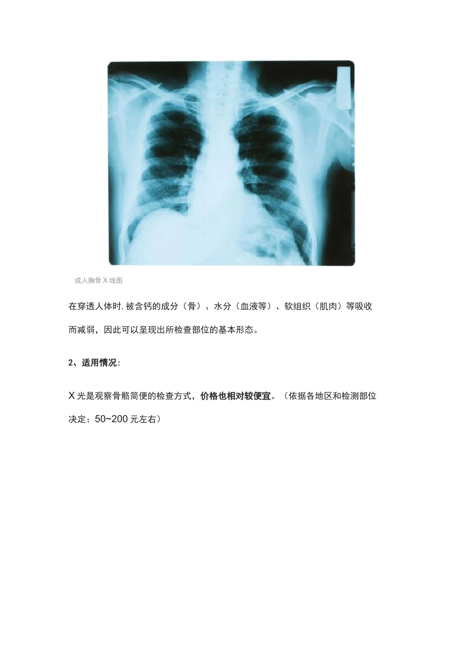 X光片、CT、核磁有什么区别？看病用哪个好？一个比喻你就明白了_第2页