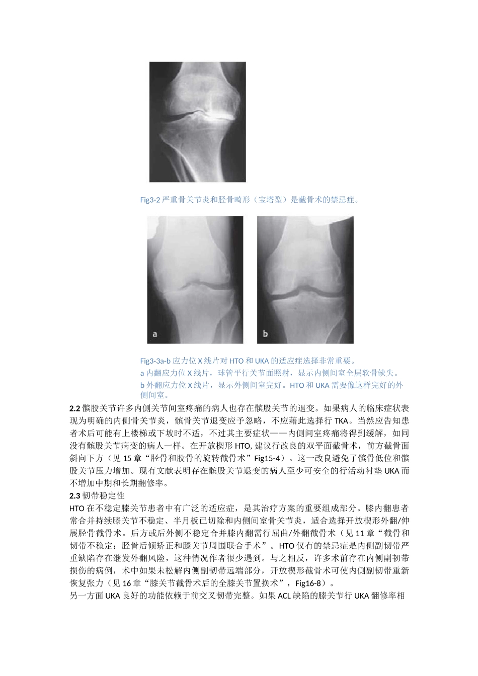 第3章 胫骨高位截骨、膝关节单髁置换和全膝关节置换的适应症_第2页