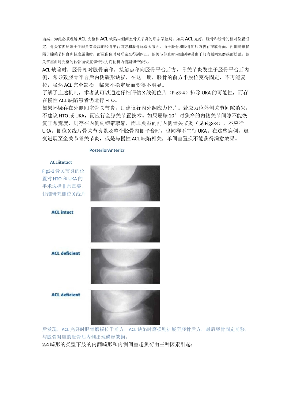 第3章 胫骨高位截骨、膝关节单髁置换和全膝关节置换的适应症_第3页