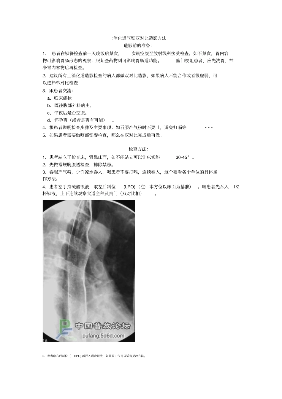 上消化道气钡双对比造影方法_第1页