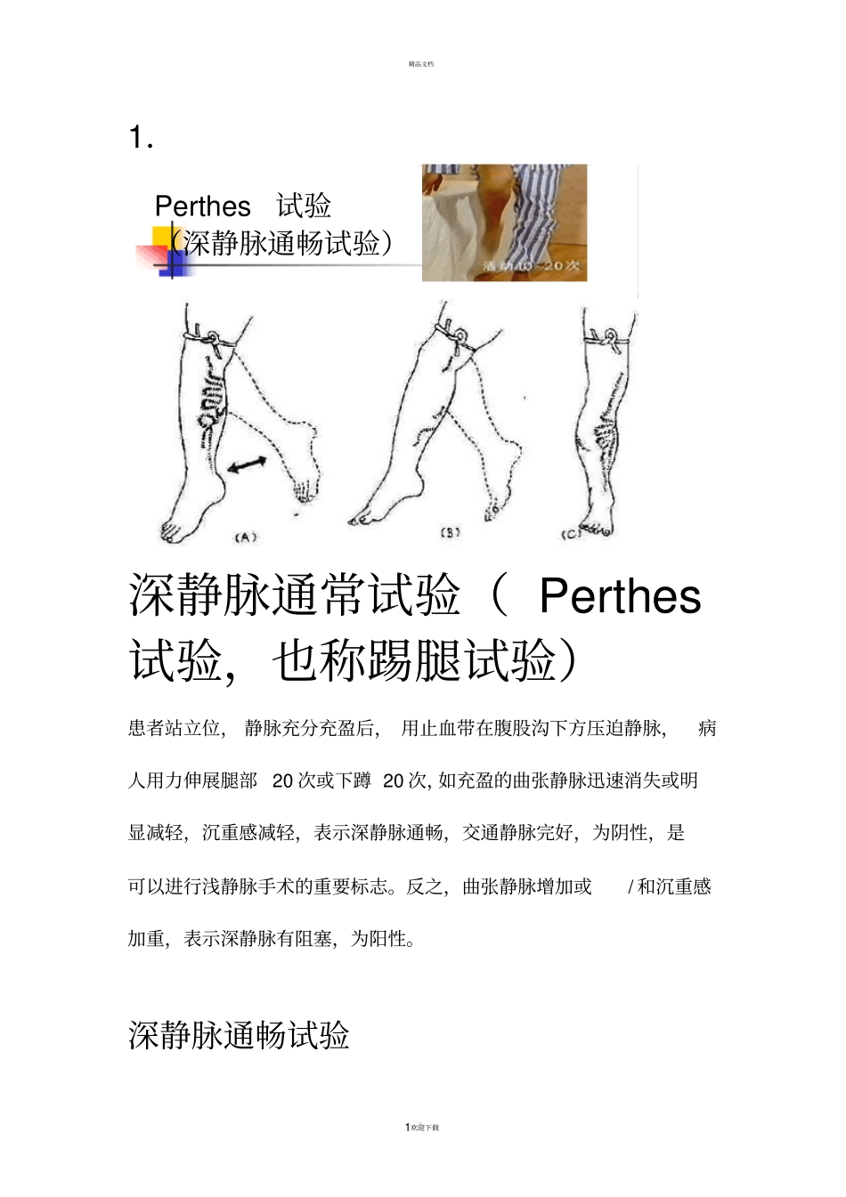 下肢静脉曲张三种检查方法_第1页