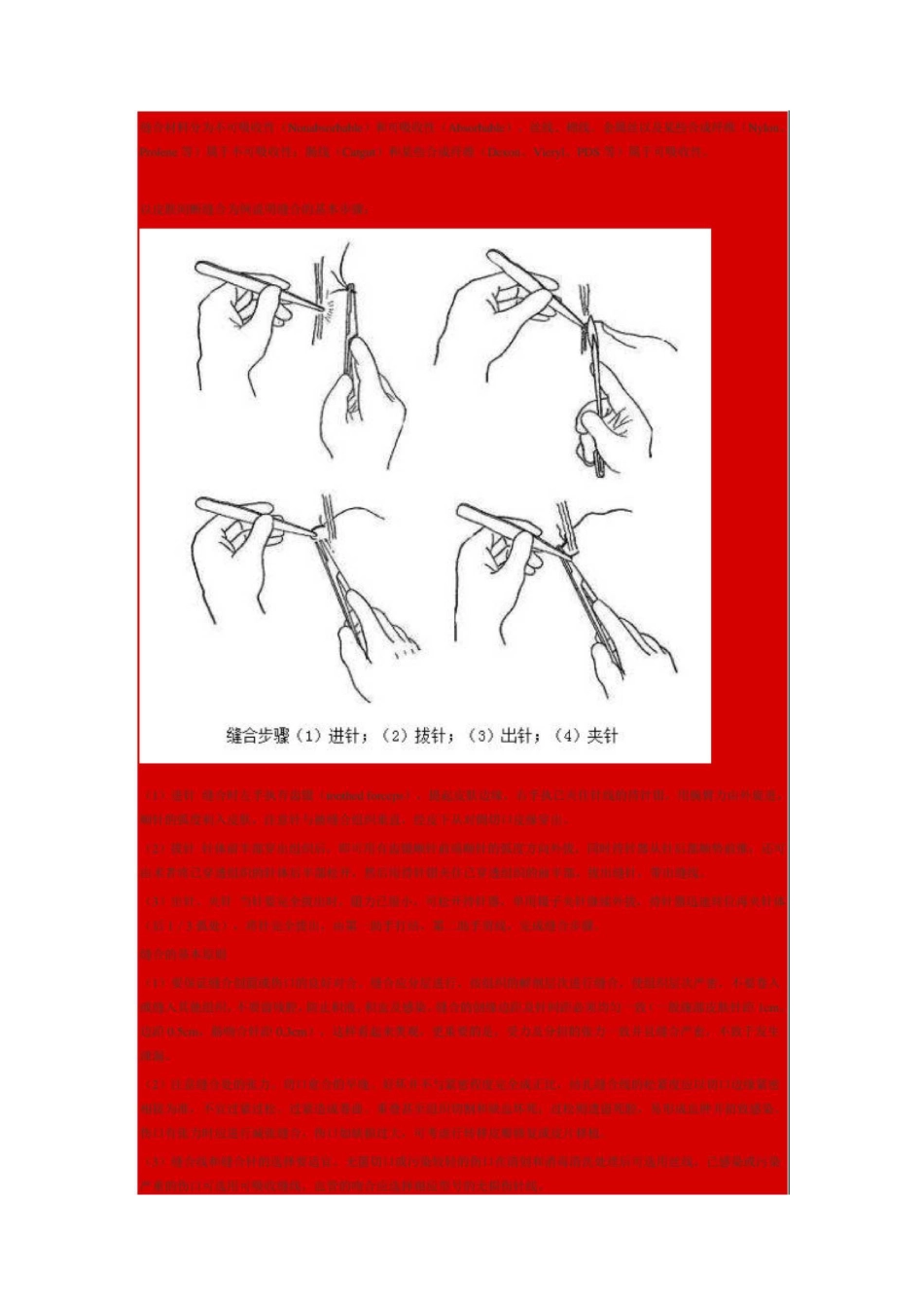 缝合手法图文讲解汇总_第1页