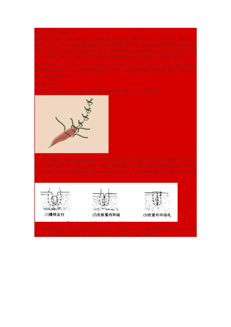 缝合手法图文讲解汇总_第2页