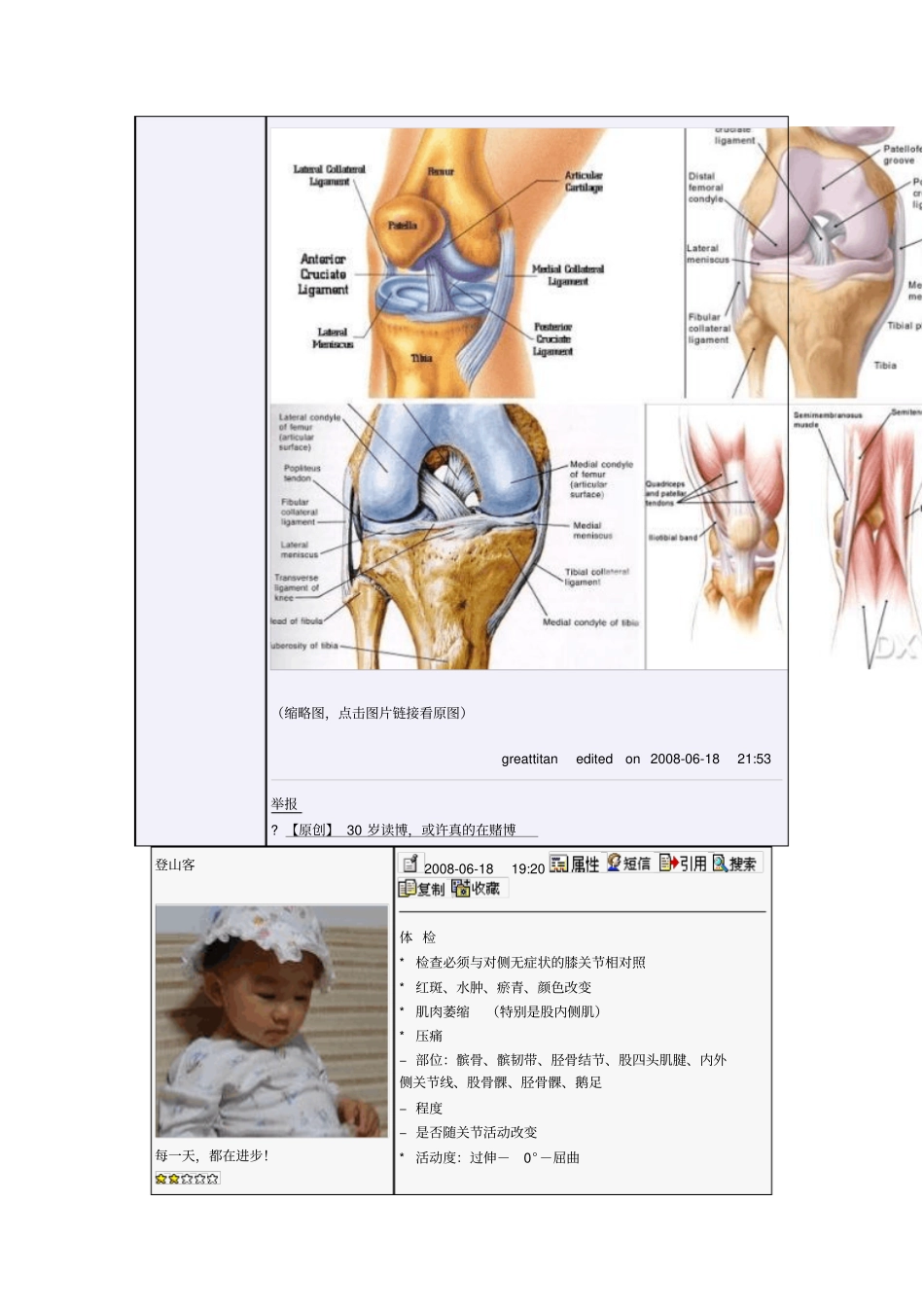 专题讲座】膝关节疼痛的诊断和鉴别诊断_第2页