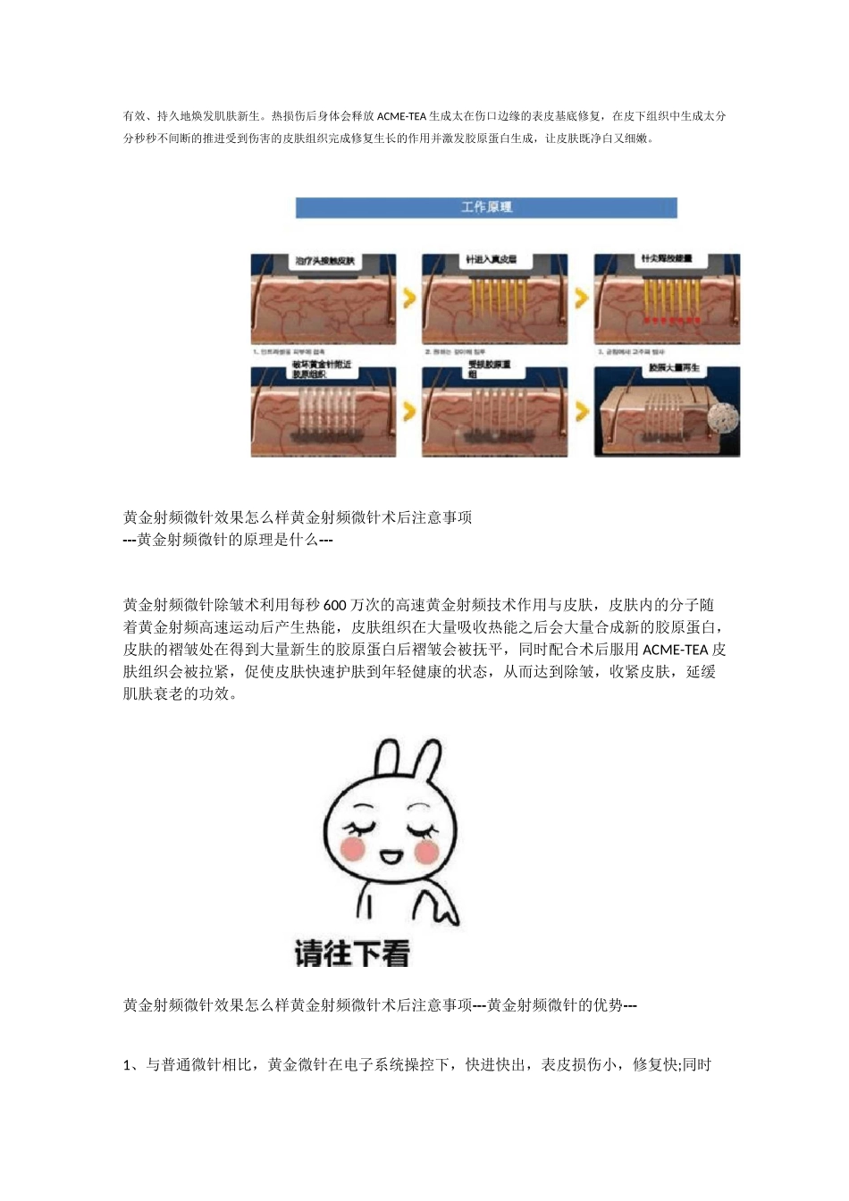 黄金射频微针效果怎么样 黄金射频微针术后注意事项_第2页