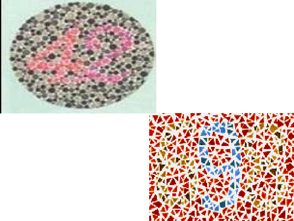 第1节人类的遗传病_第3页