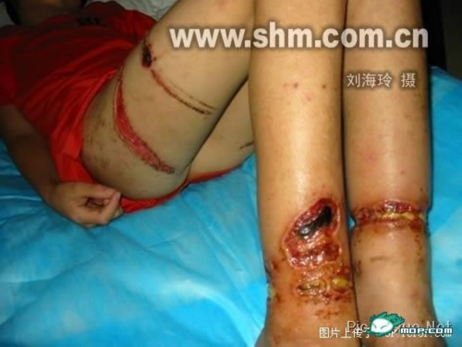 优质课善用法律保护自己_第3页