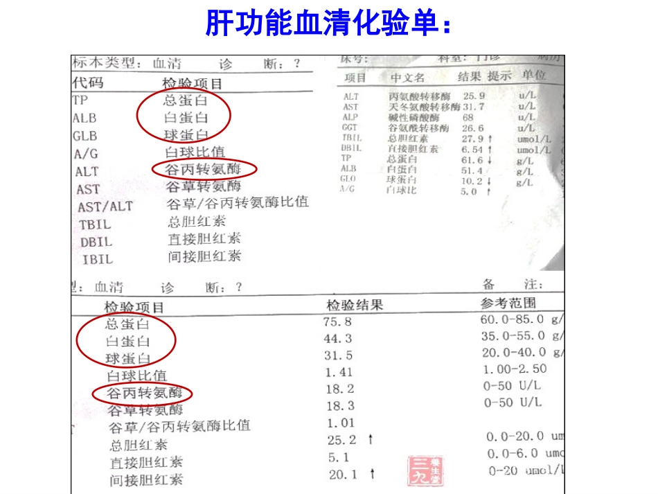 血脂代谢的调节_第2页
