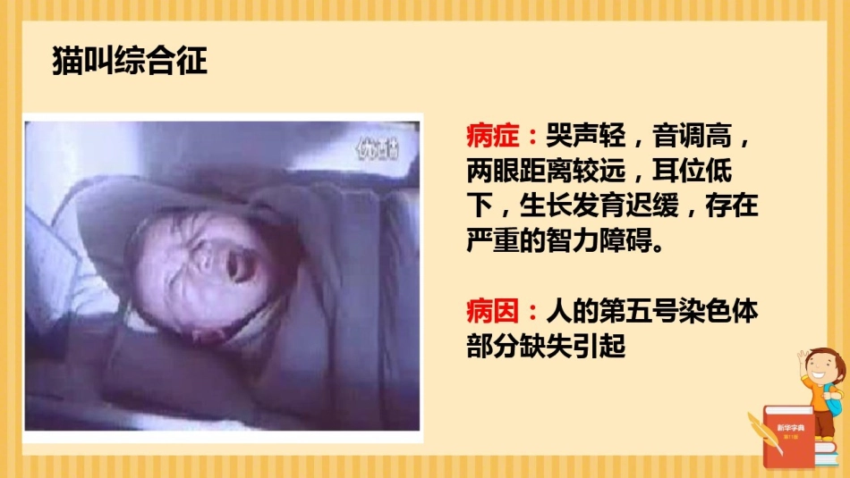 染色体结构的变异_第2页