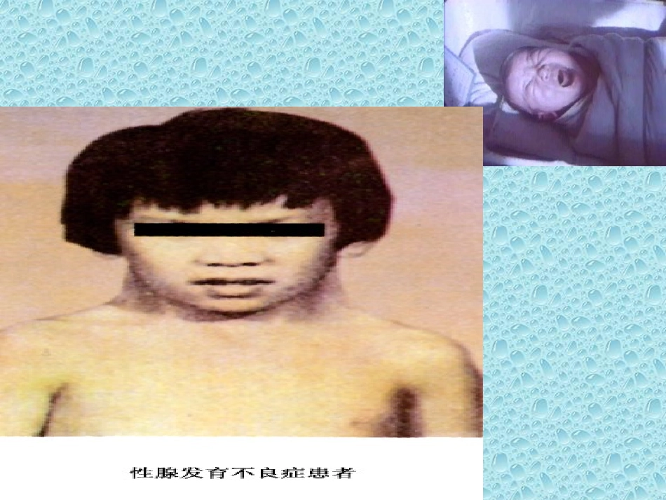 染色体数目的变异_第1页